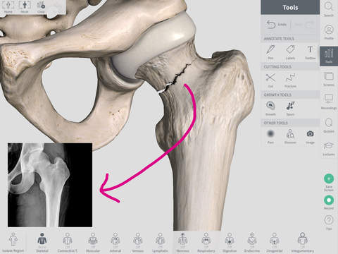 Complete Anatomy for iPad iPadアプリ